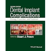 Dental Implant Complications: Etiology, Prevention, and Treatment ...