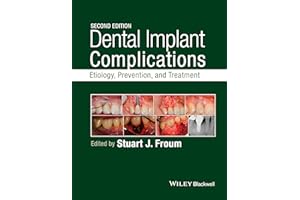 Dental Implant Complications: Etiology, Prevention, and Treatment