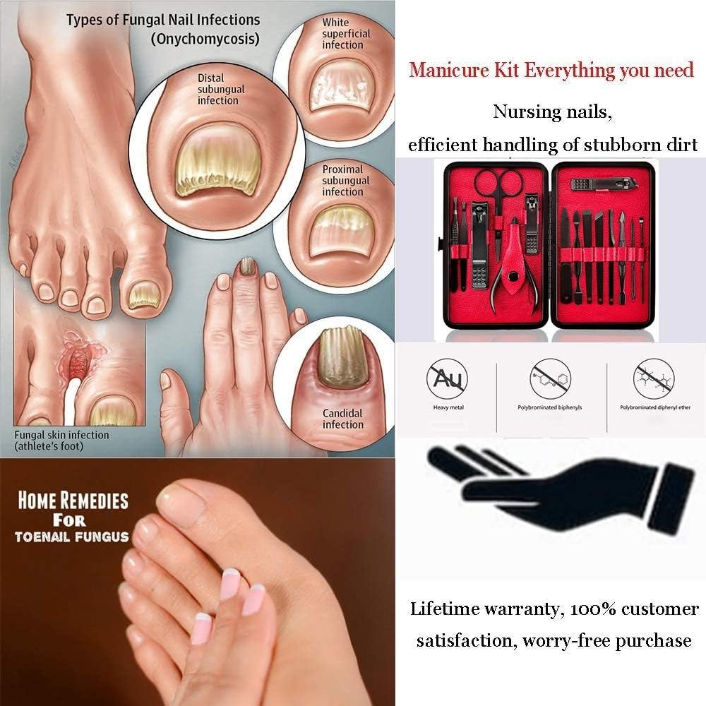 Manicure Pedicure Set Nail Clipper Set -15 Piece Stainless Steel Heavy Duty Nail Care Aids -Fingernail Clippers,Toenail Clippers -Portable Travel & Grooming Kit Tools -Deluxe (Black&Red): Health & Personal Care