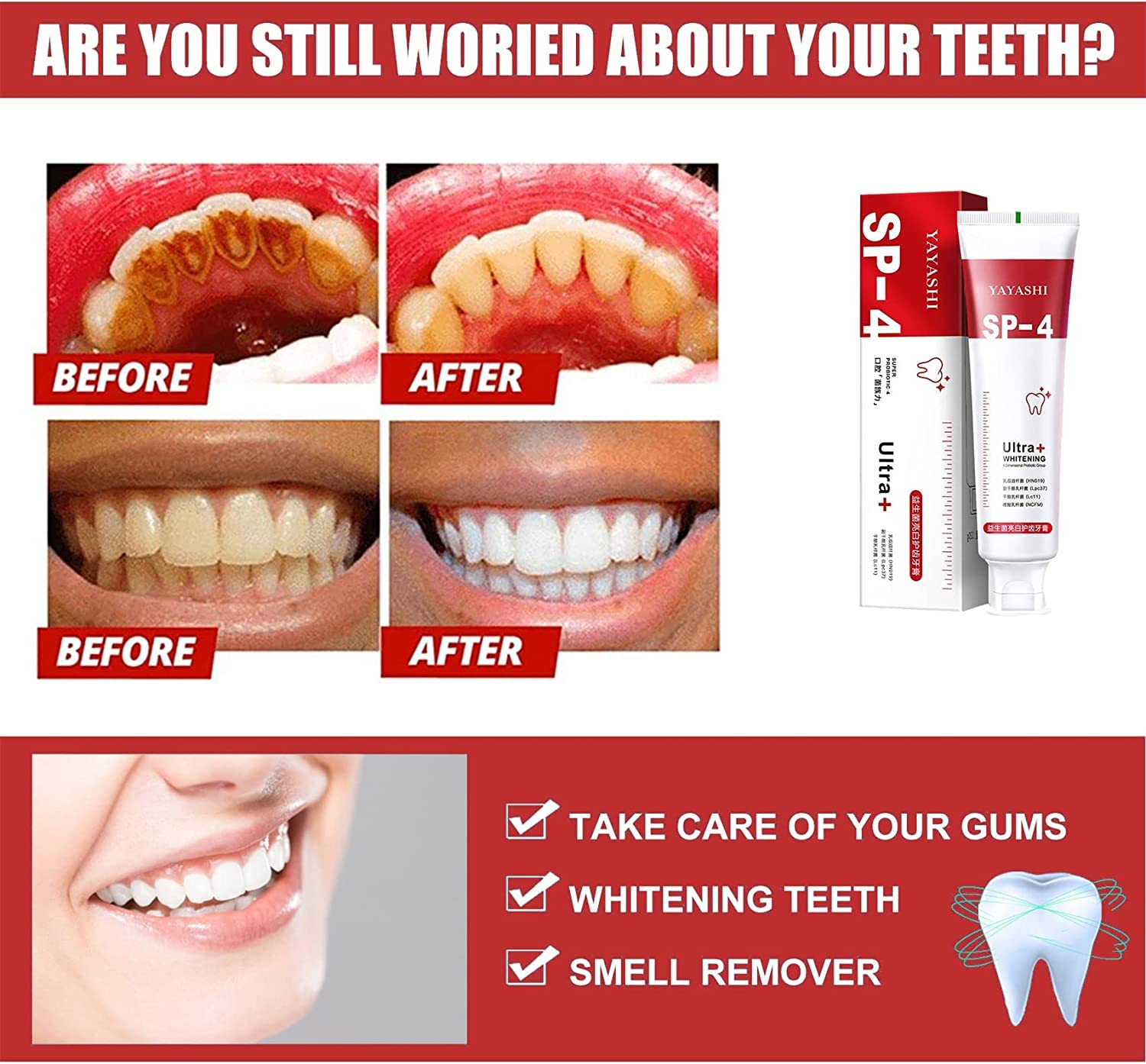 Sp-4 Probiotic Whitening Toothpaste, Ultra Whitening Toothpaste, Sp-4 Ultra Whitening (Red)