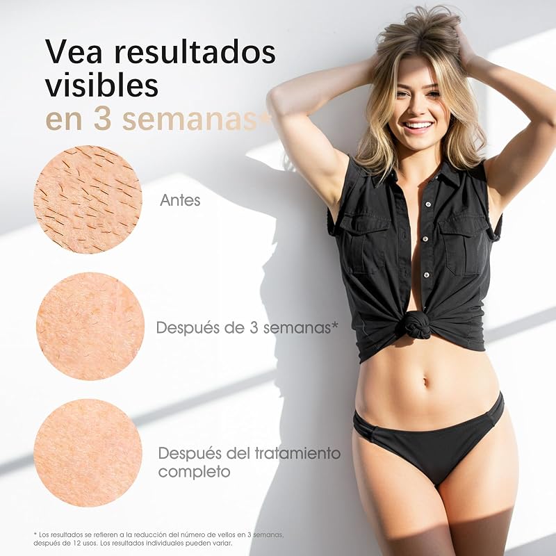 Depiladora Laser IPL con Refrigeración para Mujer y Hombre, GLY07