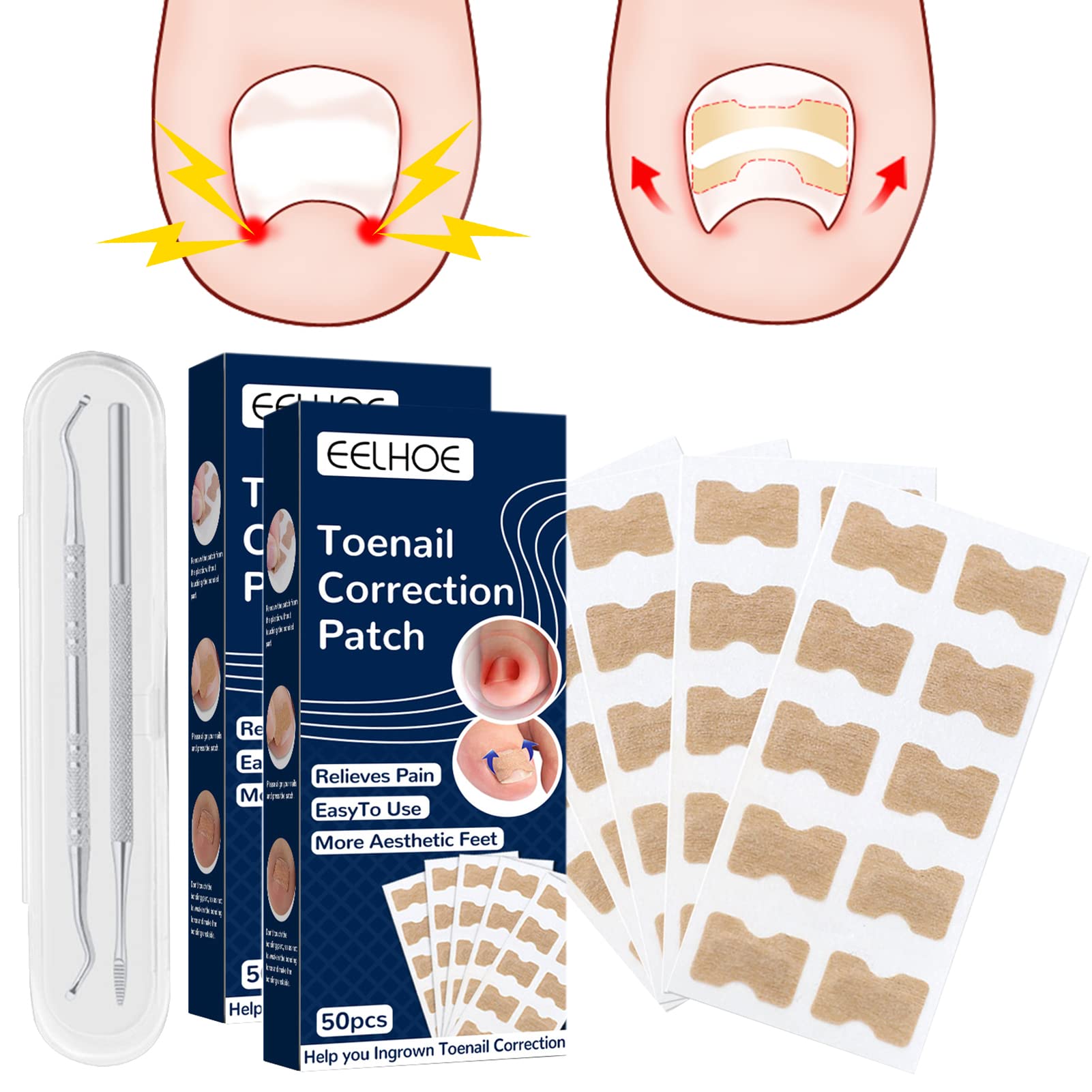 100PCS Ingrown Toenail Corrector, Toenail Correction Tool