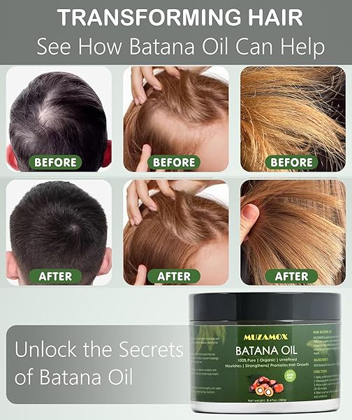 MUZAMOX BATANA OIL FOR HAIR GROWTH DR SEBI ORGANIC, 100% PURE, UNREFINED AND RAW BATANA OIL FROM HONDURAS, PROMOTES HAIR GROWTH FOR MEN & WOMEN, 8.43 OZ