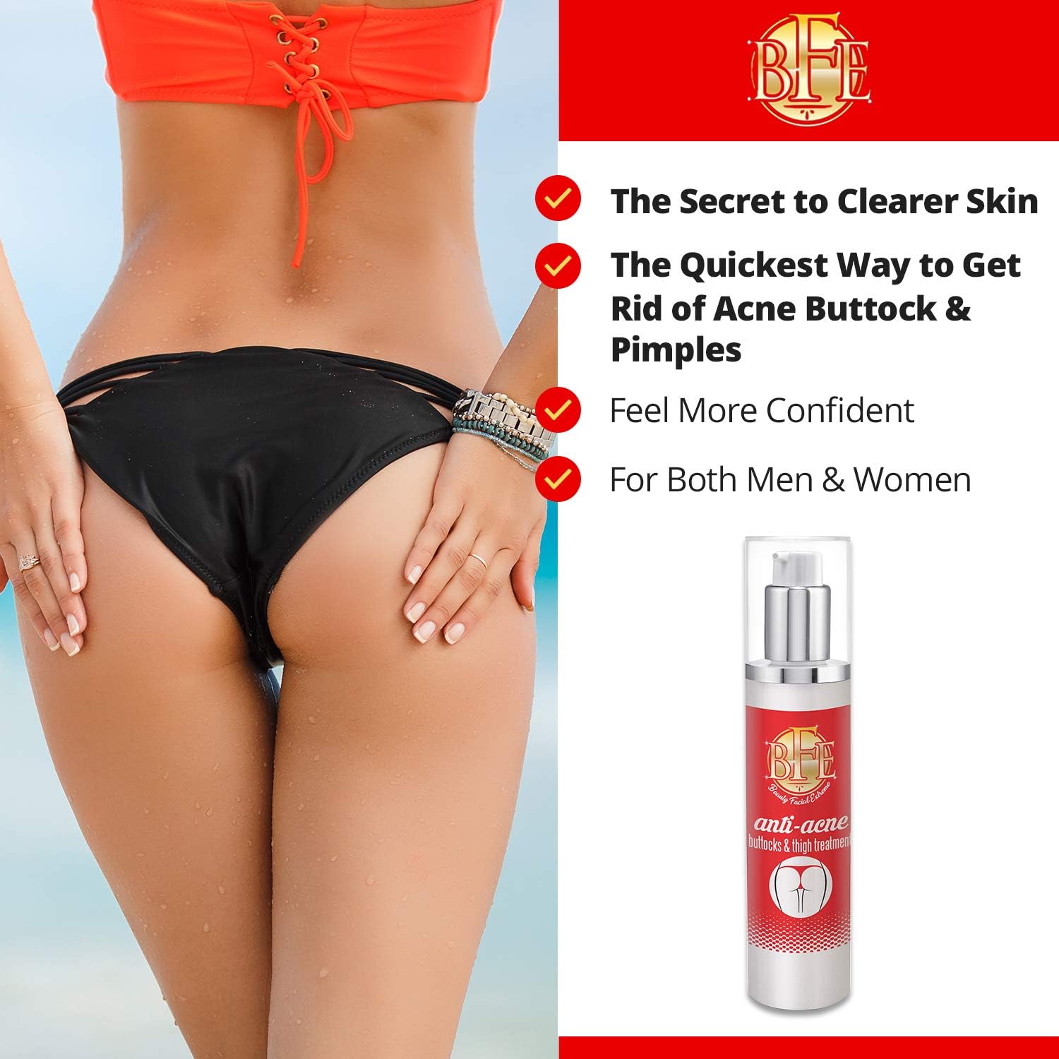 Anti Acne Buttocks Thigh Treatment Clears Away Acne Pimples