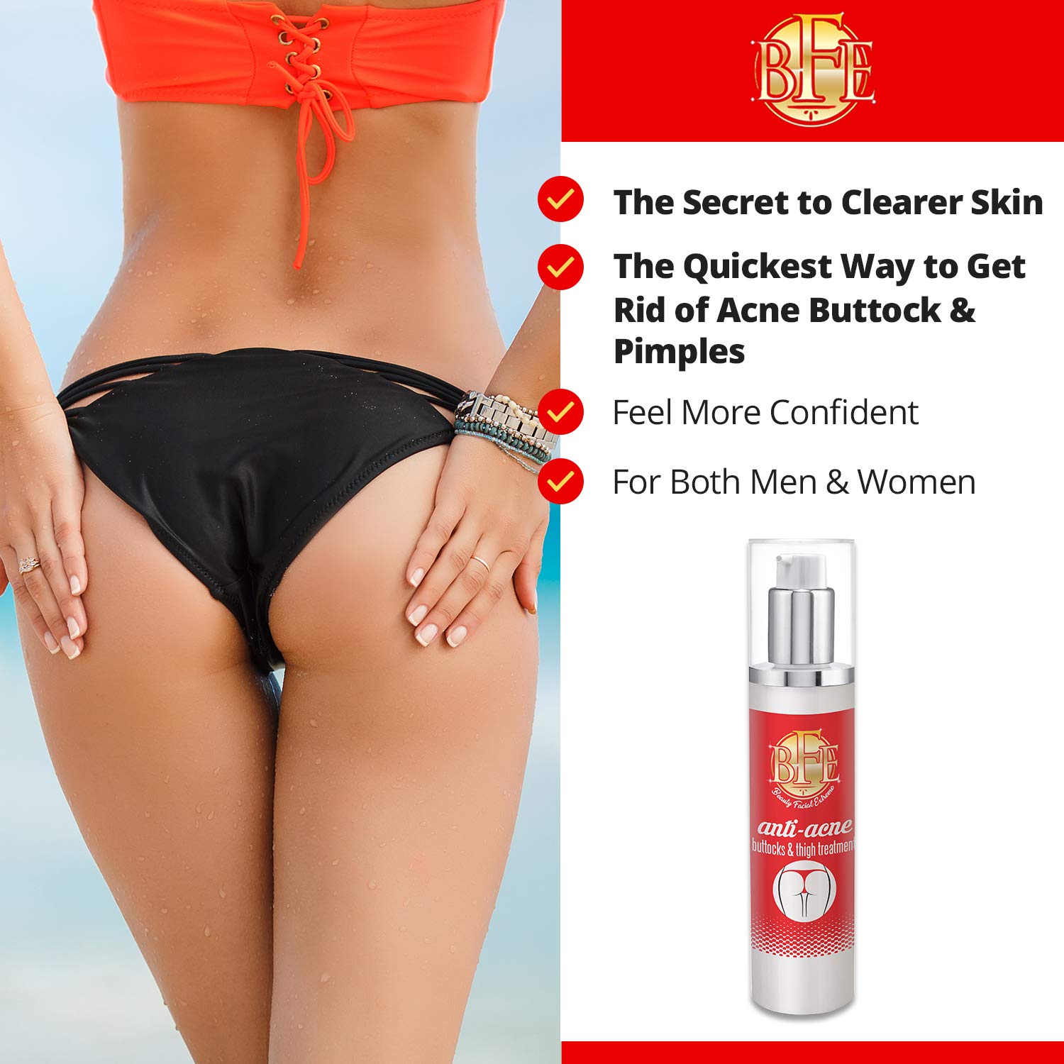 Anti Acne Buttocks Thigh Treatment Clears Away Acne Pimples