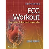 ECG Workout: Exercises in Arrhythmia Interpretation