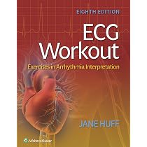 Pathophysiology of Heart Disease: An Introduction to