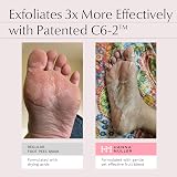 Hanna Müller Foot Peel Mask for Hard Skin Cracked Heels AHA Salicylic Acid view 2