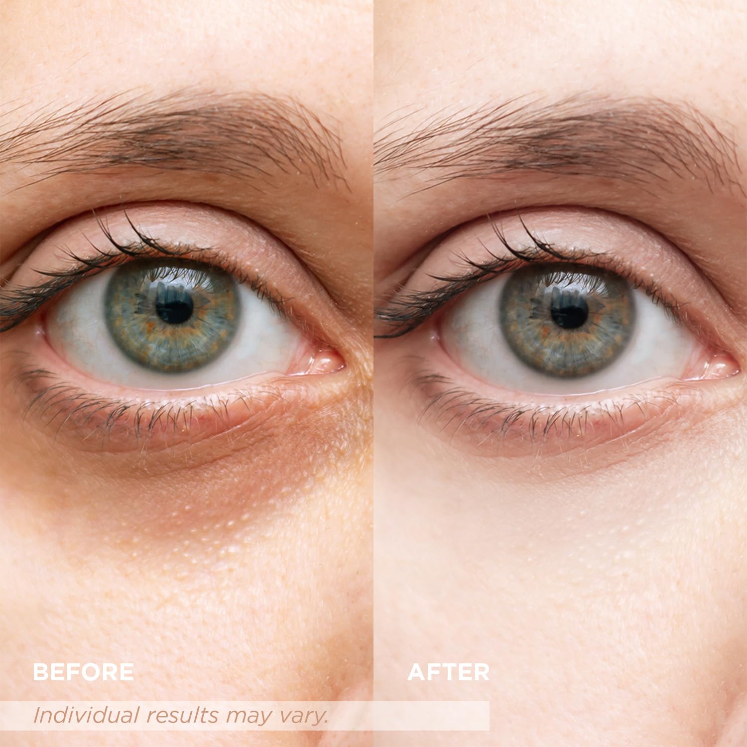 VELAMO ADVANCED Luminous Eye Corrector SPF 41: Under Eye Color Corrector for Dark Circles, Fine Lines & Puffiness - Hydrating Anti Aging Eye Cream with Ceramides Complex - Medium, 0.34 FL OZ/10mL