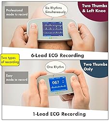 EMAY 6L Portable ECG Monitor | Record ECG and Heart