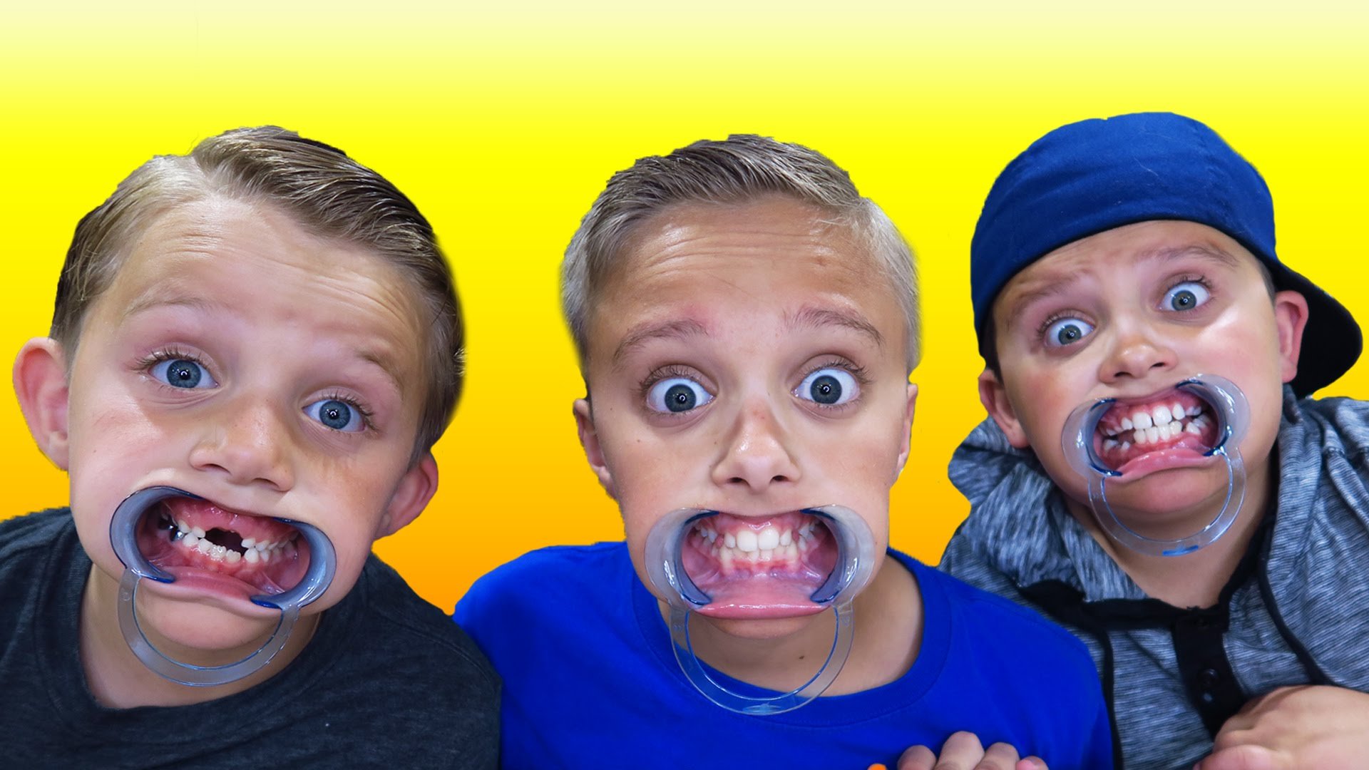 Speak Now out Mumbo Jumbo Family Edition Mouth Guard Game - Family Party Game Children - Best Mouthpiece Talking Rubbish Challenge Game