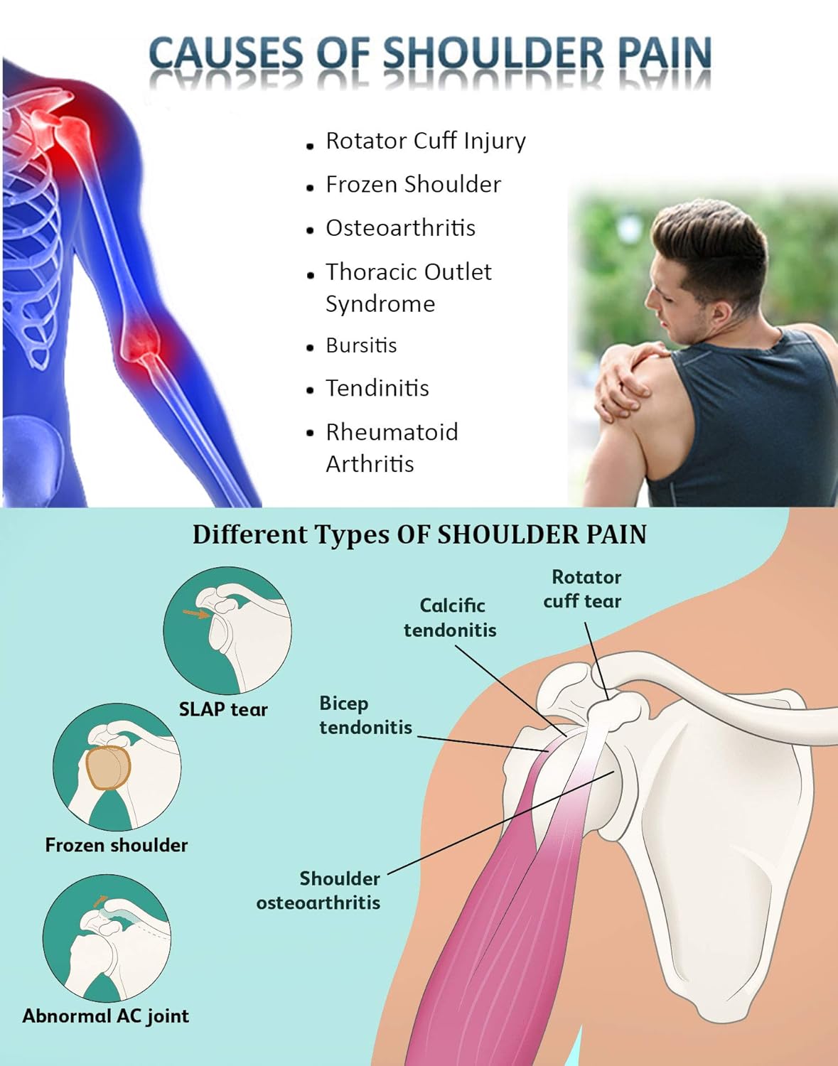 Wonder Care-Left Right Shoulder Immobilizer Arm Sling Elastic Brace for Clavicle Collar Bone Dislocation Subluxation Shoulder stabilizer Compression Brace After Rotator Cuff Surgery -Uni: Industrial & Scientific