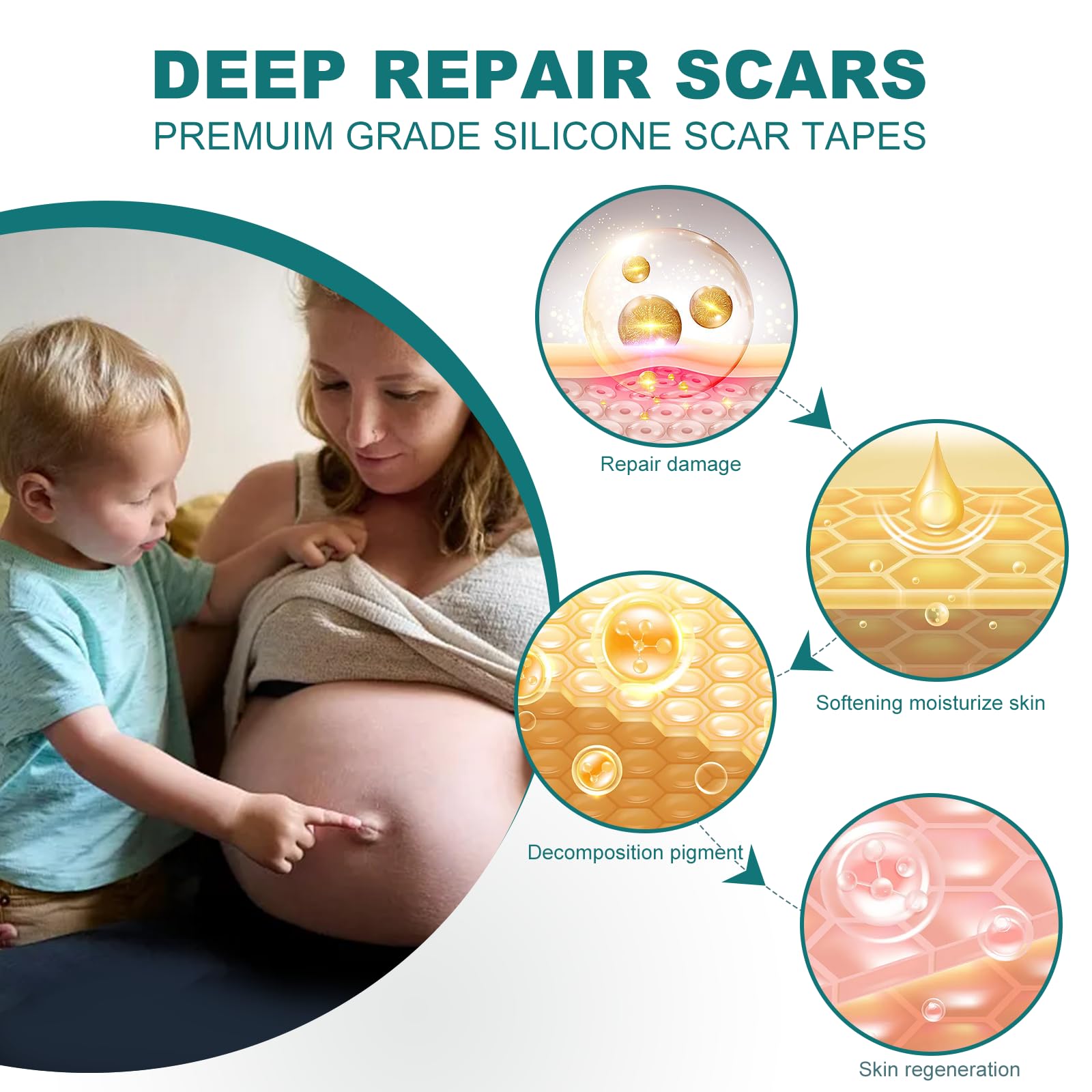 SLUKHIG Silicone Scar Sheets (1.6