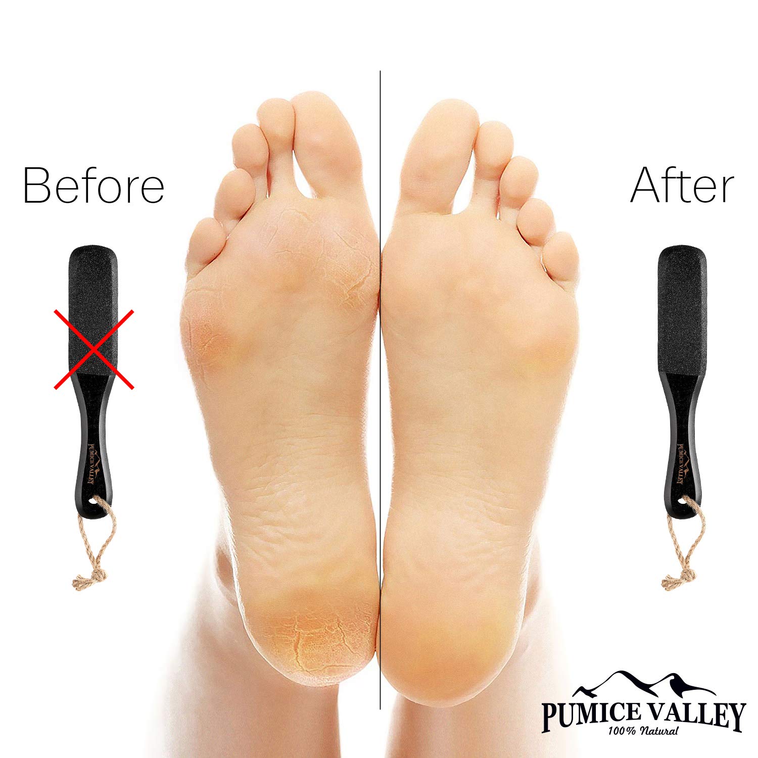 Pumice Stone Foot Scrubber - Pedicure Foot File with Handle for Dry Dead Skin - Callus Remover for Feet - Foot Scraper - Exfoliating Brush for Heels, Elbows, Hands : Beauty