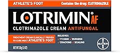 Lotrimin AF Cream for Athlete's Foot, Clotrimazole 1% Antifungal Treatment, Clinically Proven Effective Antifungal Treatment 