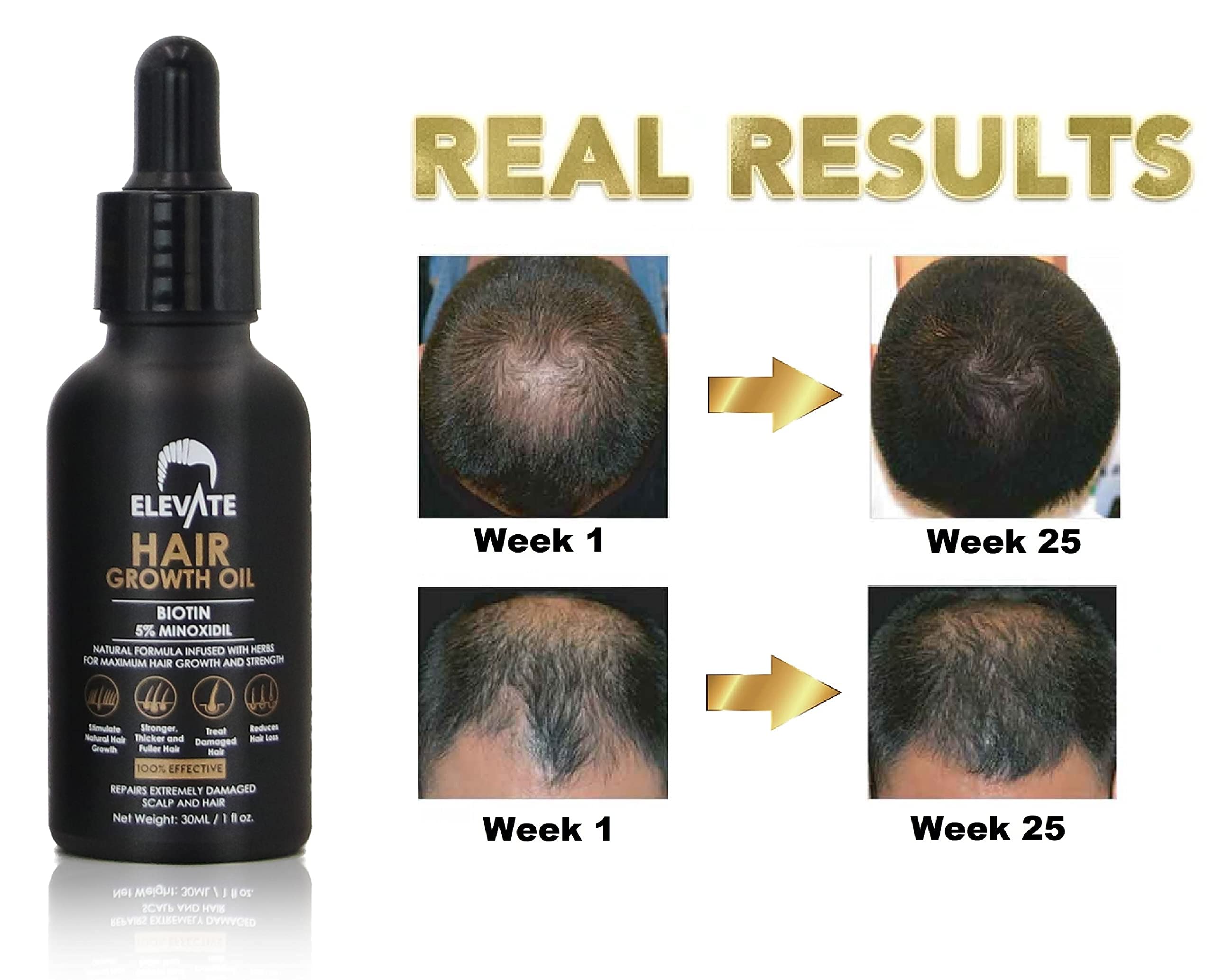 Elevate Hair Regrowth Treatment 5% Minoxidil Serum - Biotin Infused Growth Oil for Men & Women - Stop Thinning & Shedding - Restore Follicle Strength & Density for Fuller, Stronger, Healthier Hair 1oz