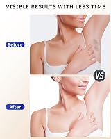 Blissky IPL Hair Removal Device, 9 Energy Levels, 999,900 Flashes view 8