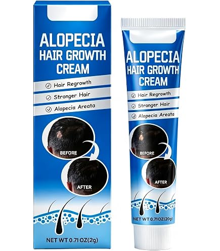 Amazon.com : ALOPECIA Amazing Hair Growth with Biotin 4oz : Beauty
