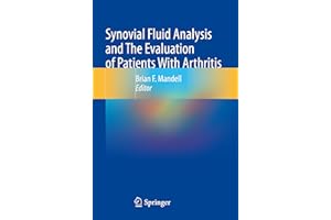 Synovial Fluid Analysis and The Evaluation of Patients With Arthritis