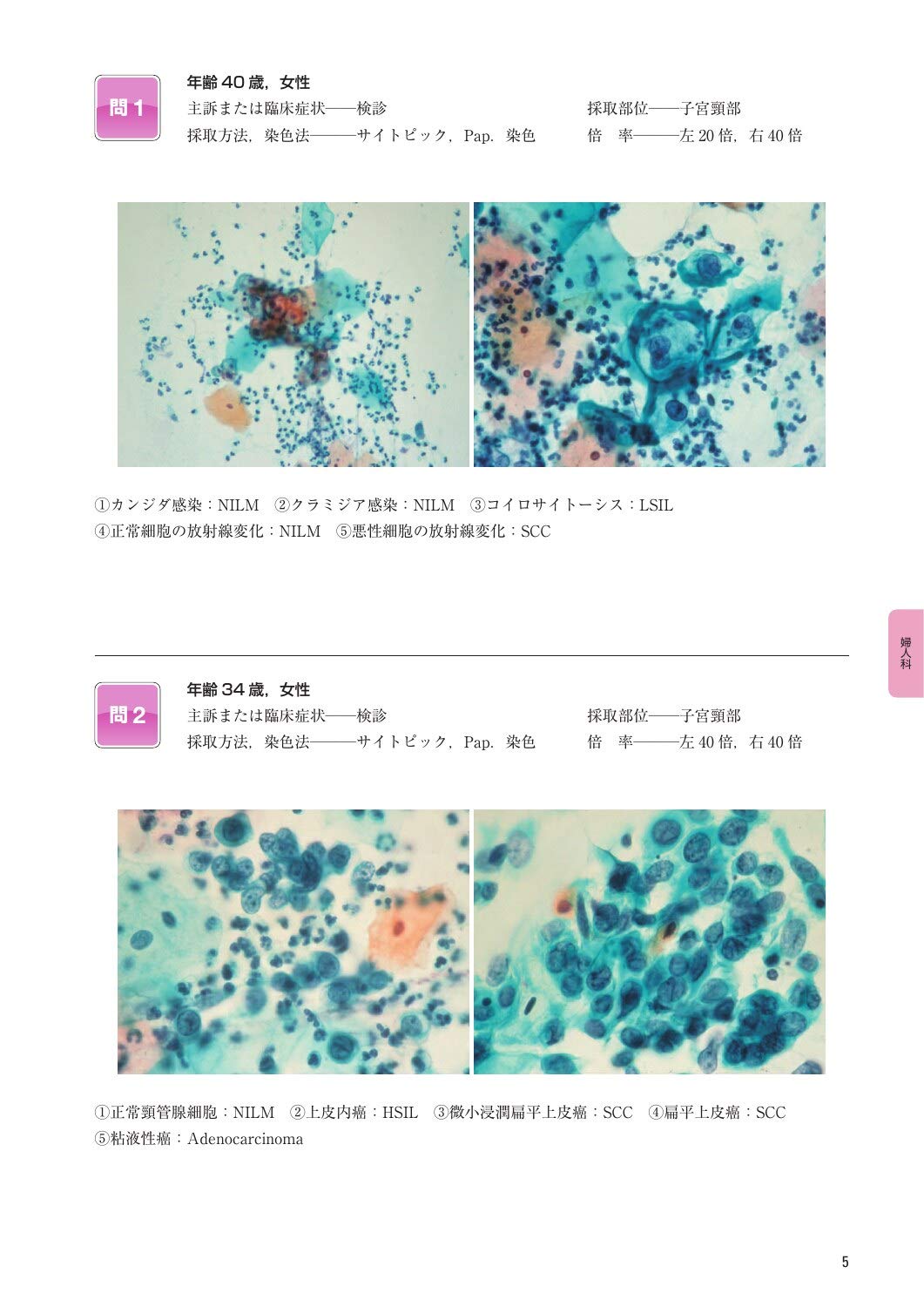 おしゃれ 細胞検査士細胞像試験問題集 待望の再入荷 Nepalbreweries Com
