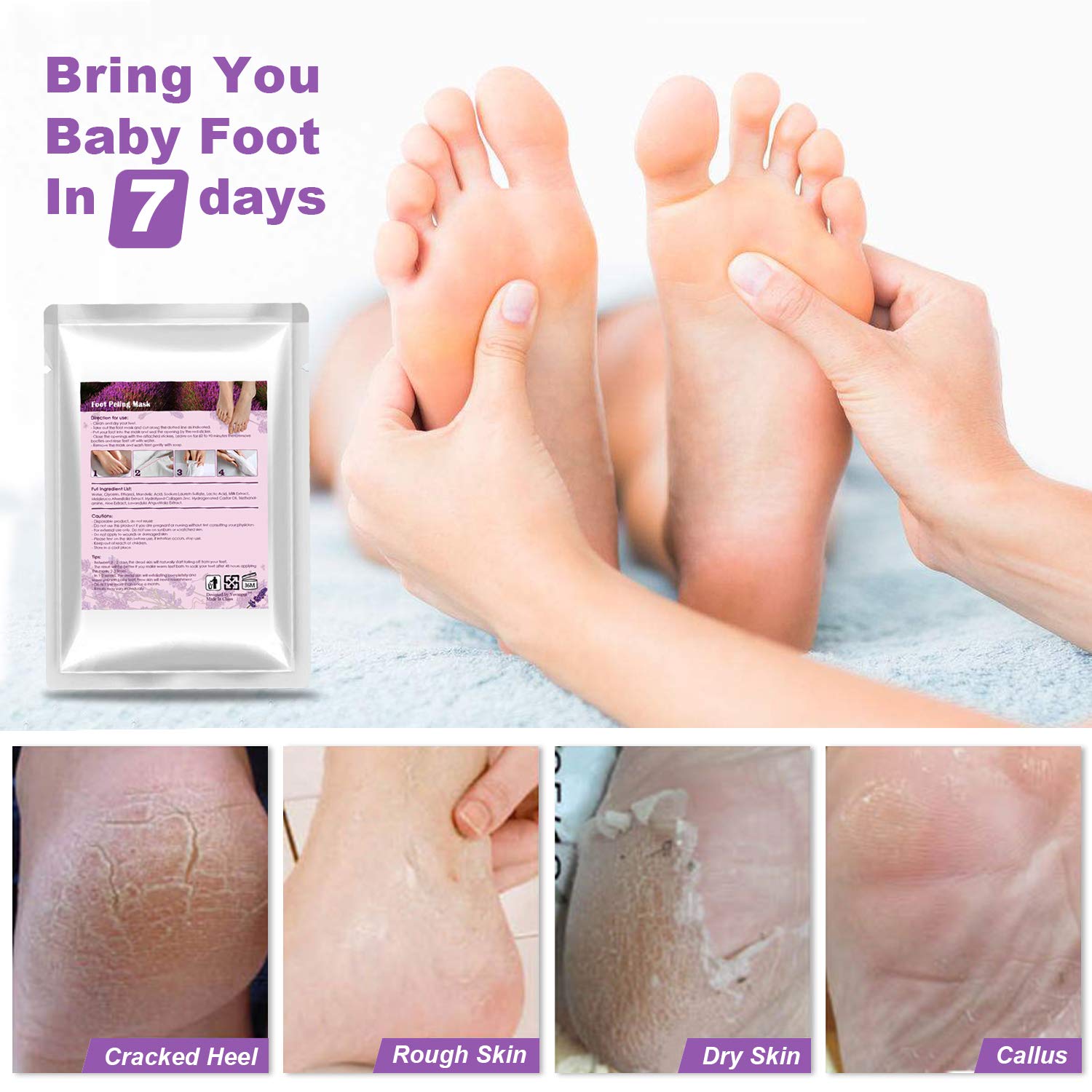 baby foot fotpeeling