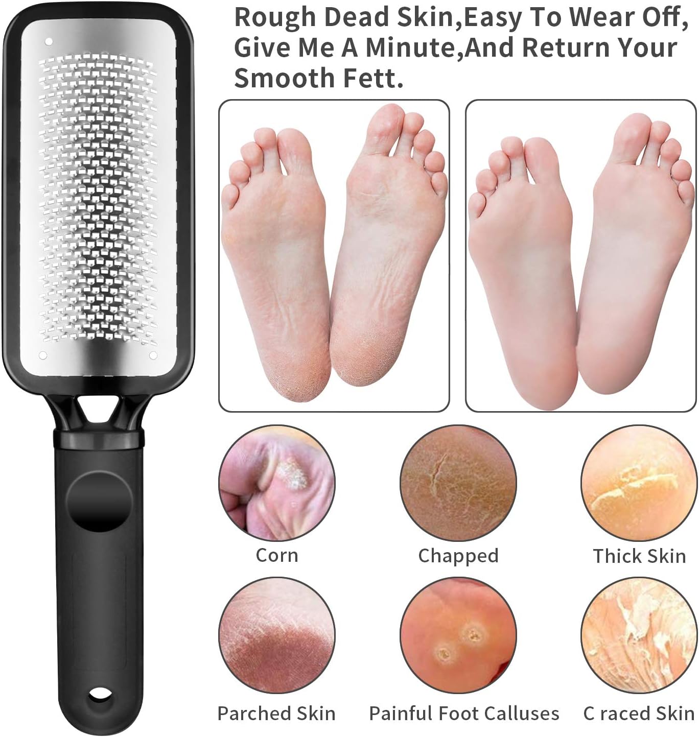 pedicure Foot File Callus Remover - Large Stainless Steel foot scraper, Remove Hard Skin, Practical and Professional Foot Care File, Suitable for Dry and Wet Feet: Health & Personal Care