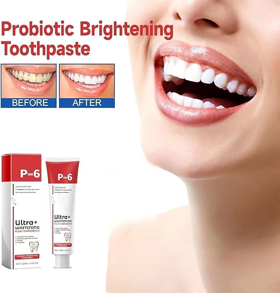 GENERIC SP-6 ULTRA WHITENING, SP 6 TOOTHPASTE, ULTRA WHITENING TOOTHPASTE SP – 6, PROBIOTIC BRIGHTENING TOOTHPASTE,DEEP CLEANING CARE TOOTHPASTE,FRESH BREATH(1PCS). MILKY WHITE#1