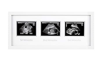 gifts for expecting parents amazon