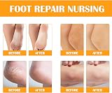 Fashion Base Foot Spray 100ml Callus Remover Cracked Heel Dead Skin Repair view 5