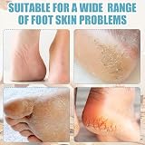 FEXPDL 4 in 1 Foot Scrubber Pumice Stone File for Dry Wet Feet view 4
