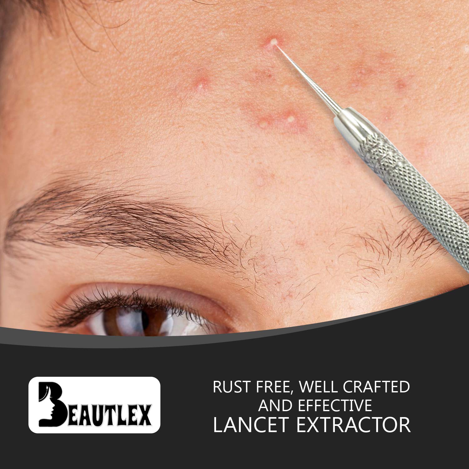Amazon Com Lancet For Facial Milia Remover And Whitehead