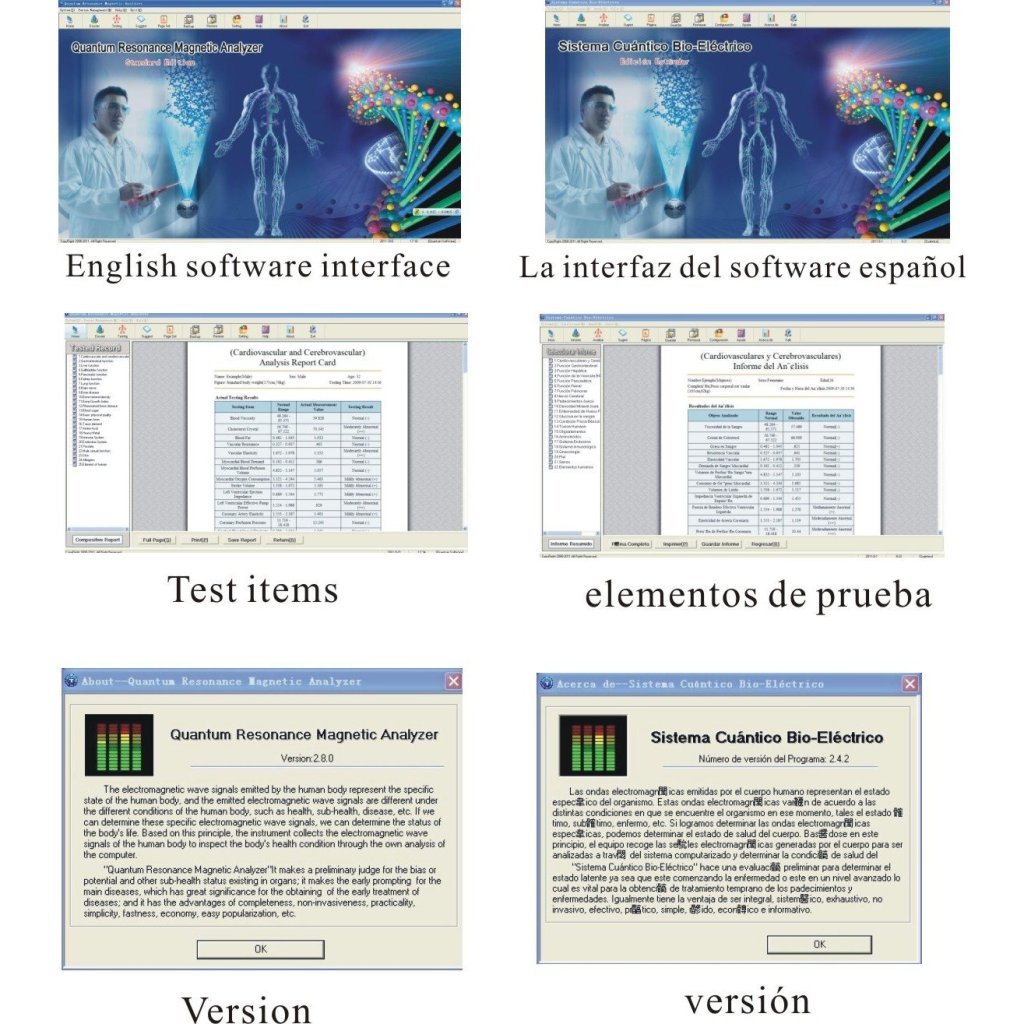 Amazon.com: USB v3.2 Mini Quantum Resonancia Magnética ...