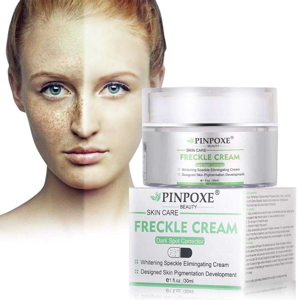 pigmentation lightening cream