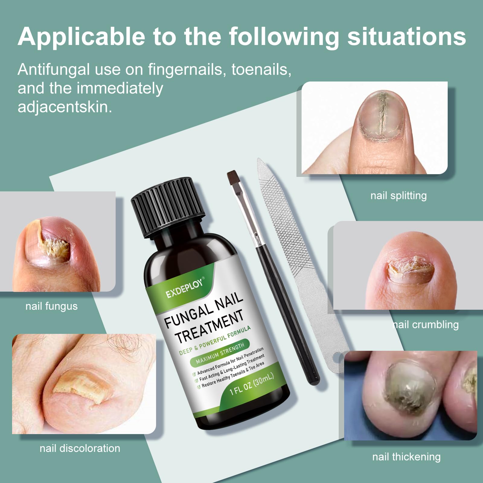 6 Pack Toenail Fungus Treatment Extra Strength with 25% Undecylenic Acid for Toenails and Fingernails with Natural Oils for Thick, Damaged & Nails foot fungus treatment extra strength - Image 2