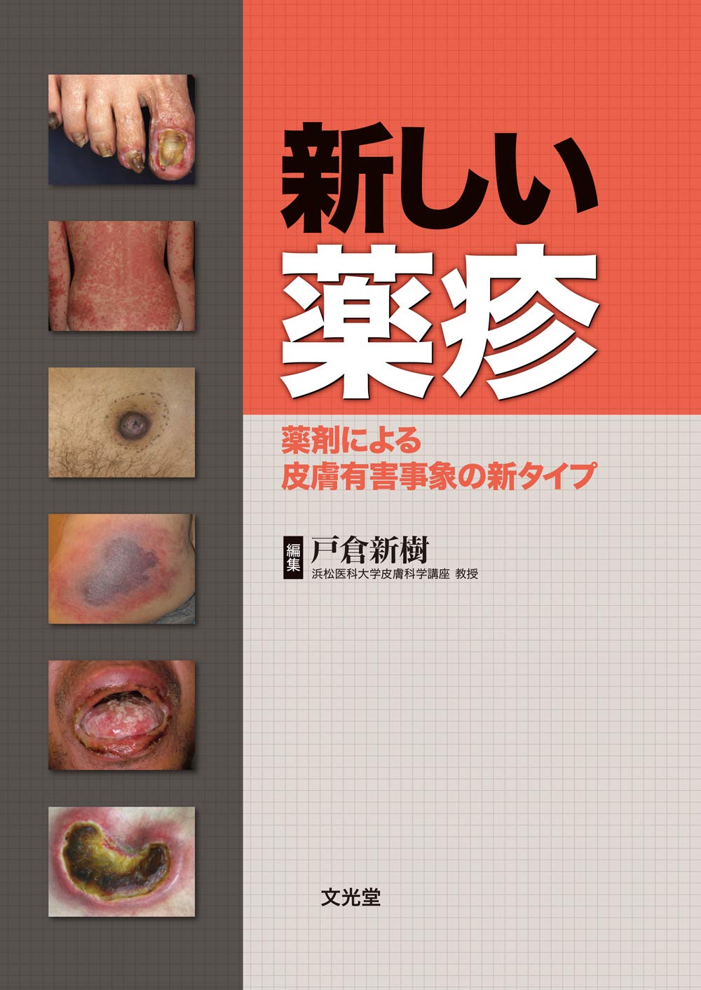 新しい薬疹 戸倉新樹 本 通販 Amazon