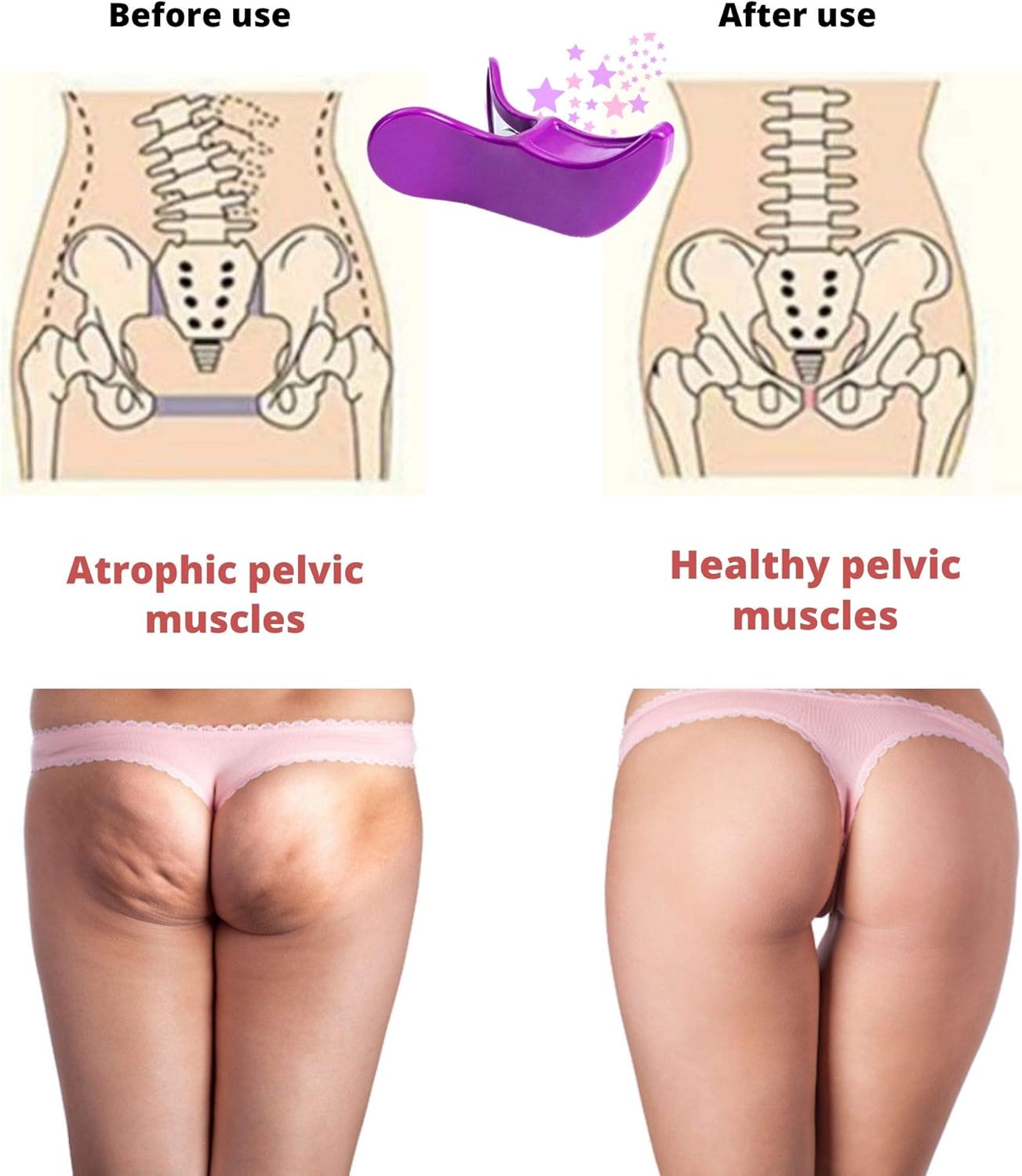 BaradzeYFerm Hip Trainer Buttocks Lifting - Pelvic Floor Muscle Exerciser - Inner Thigh Exercise Equipment - Hipsline Body Sculpt Tool - Fitness Bladder Control Exerciser - Postpartum Recovery: Sports & Outdoors