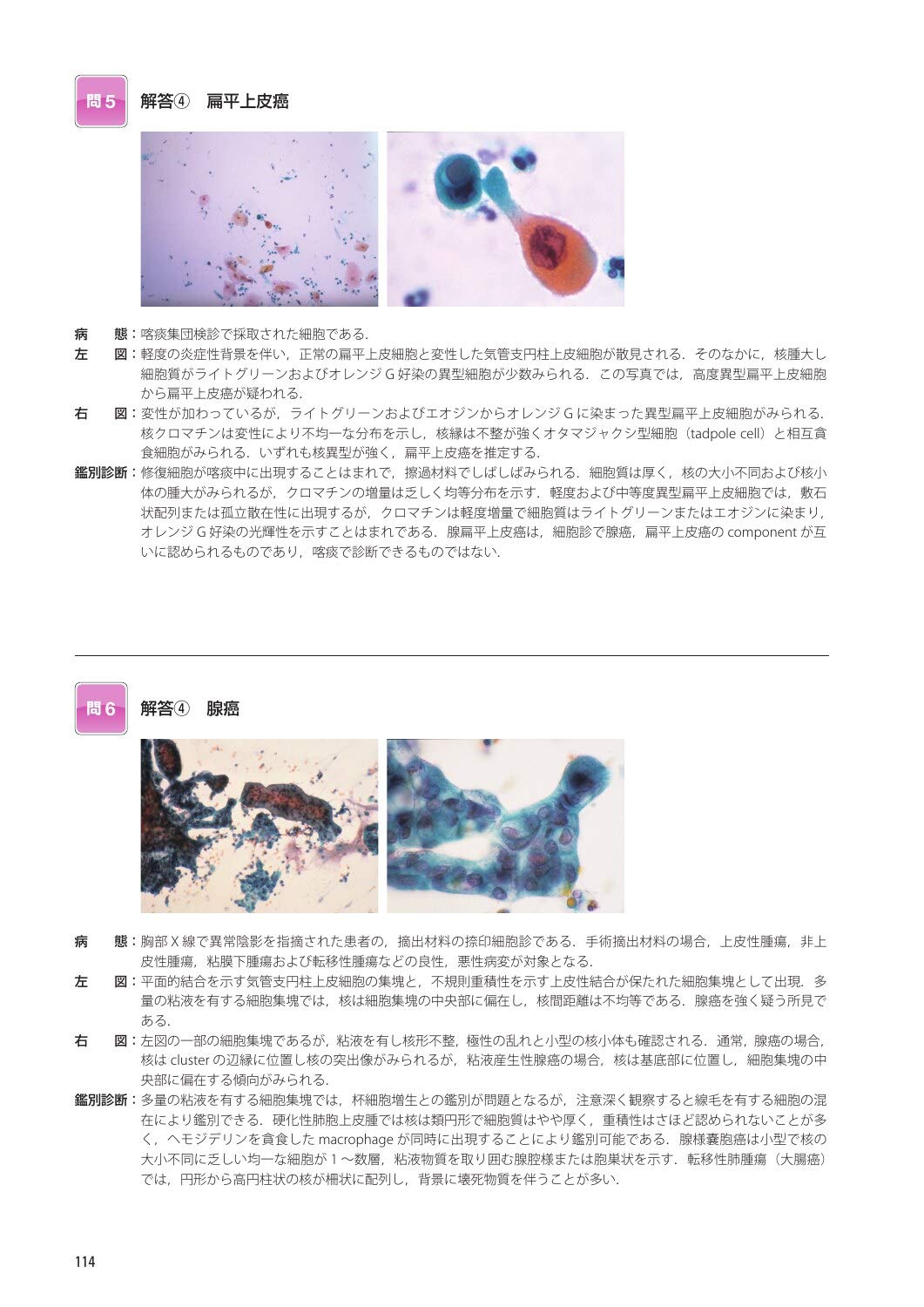 細胞検査士細胞像試験問題集 第2版 公益社団法人日本臨床細胞学会 本 通販 Amazon