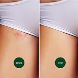 Nad's Soothing Ingrown Solution 125ml - Ingrown Hair Treatment view 5