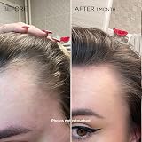 Phyto Phytocyane Anti-Hair Loss Treatment Women Ampoules 12 x 5ml view 3