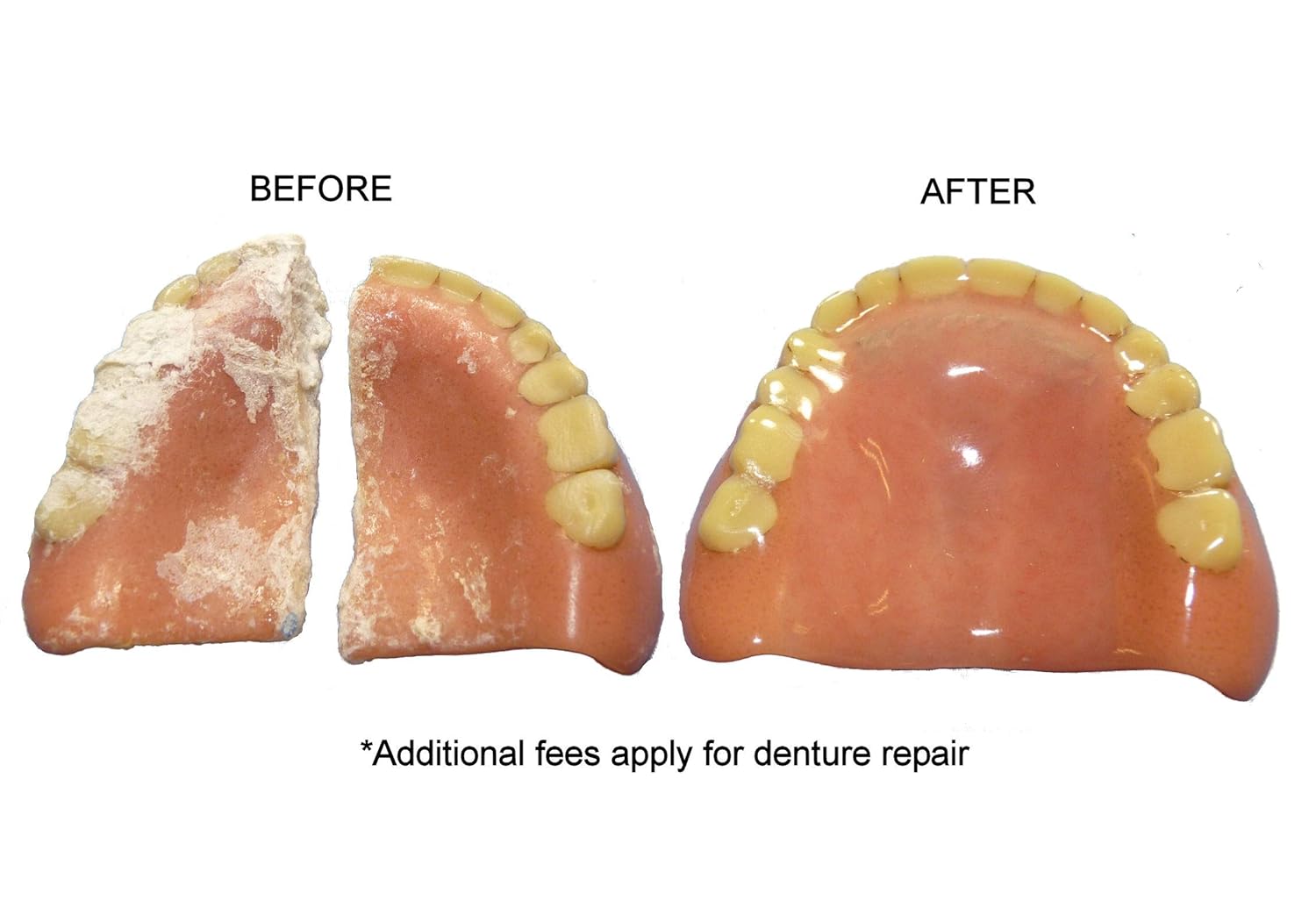 Amazon Com Denture Repair Lab Professional Denture Cleaning Denture Polishing Denture Care Services Industrial Scientific