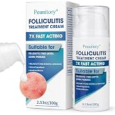 Folliculitis Treatment Cream - 5% Benzoyl Peroxide Treatment for Scalp, Body &amp; Back Bumps, Fast-Acting Relief Ointment for Itching, Redness &amp; Acne, with Centella &amp; Ceramides, Sensitive Skin, 3.53 oz