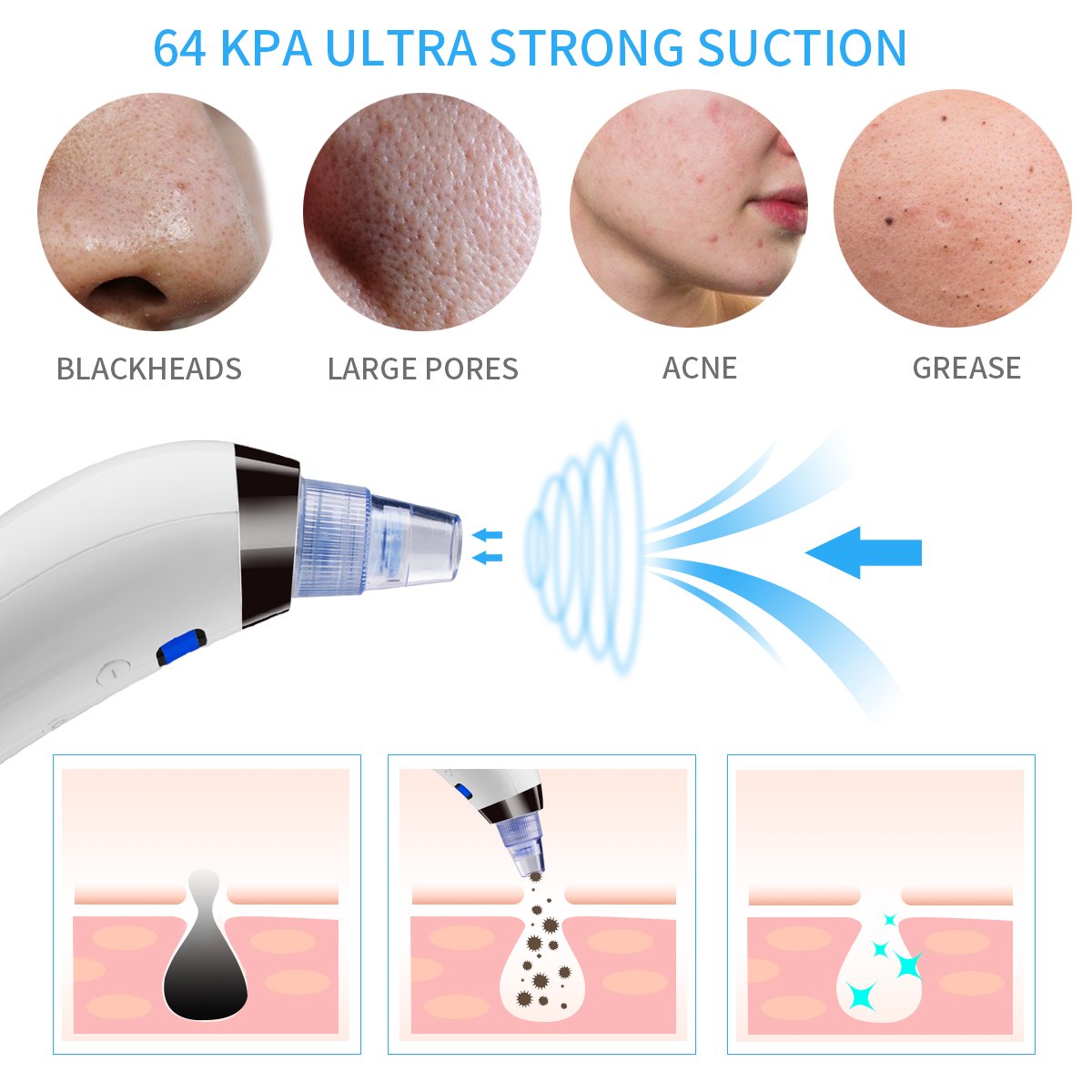 Limpiador de Poros Eléctrico, Eliminador de Espinilla Recargable del Vacío + 4 Accesorios Multifuncionales - Morpilot Máquina Multifuncional de Limpiar Poros Faciales
