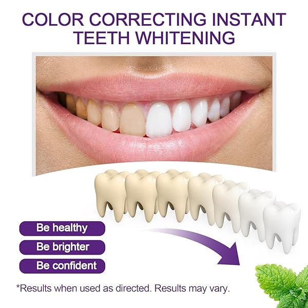 TEETH WHITENING PEN, PURPLE TEETH WHITENING GEL PENS, INSTANT WHITENING PENS FOR TOOTH STAIN REMOVAL, 3 PACKS