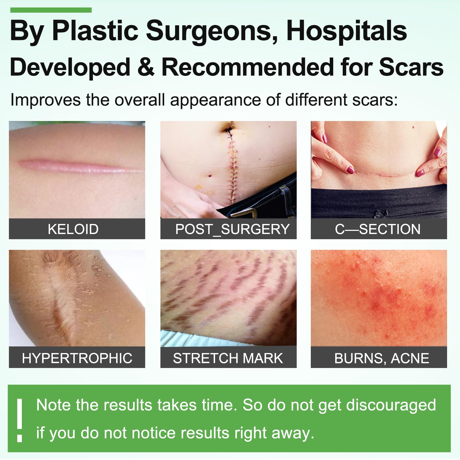 Silicone Scar Sheets (1.6” x 120” Roll-3M), Silicone Scar Tape Roll, Scar Silicone Strips, Reusable, Professional Scar Removal Sheets for C-Section, Surgery, Burn, Keloid, Acne et