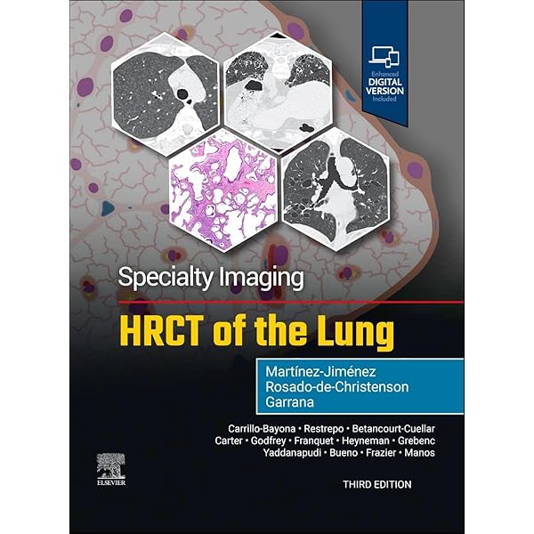 Amazon.com: Diagnostic Imaging: Chest: 9780323796637: Rosado-de