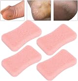 YUYTE Pumice Stone 4pk Pink Foot Callus Remover Hard Skin Pedicure Scrubber view 5