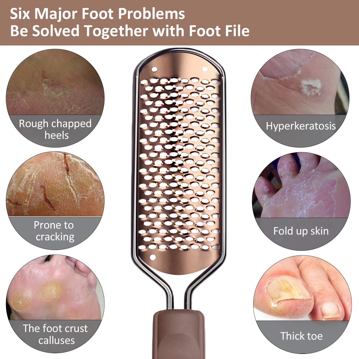 Pedicure Foot File Callus Remover - BTArtbox Large Foot Rasp Colossal Foot Scrubber Professional Stainless Steel Callus File for Wet and Dry Feet : Beauty