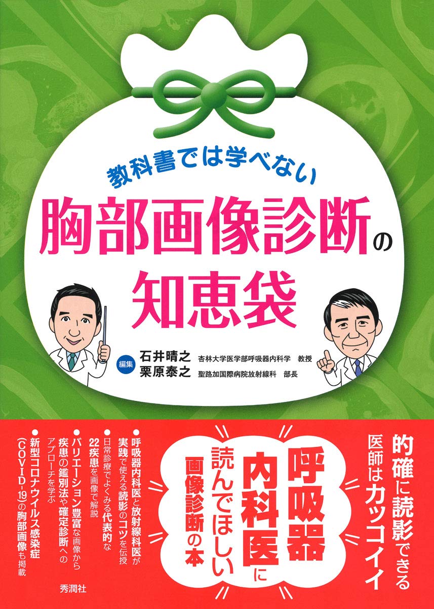 教科書では学べない 胸部画像診断の知恵袋 Amazon Com Books