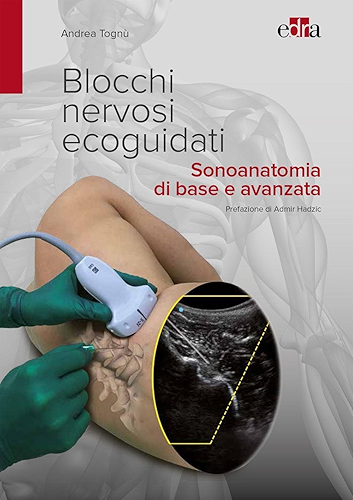 Download Blocchi nervosi ecoguidati: Sonoanatomia di base e avanzata (Italian Edition) PDF