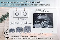 Sonogram Picture Frame, Ultrasound Photo Frame with